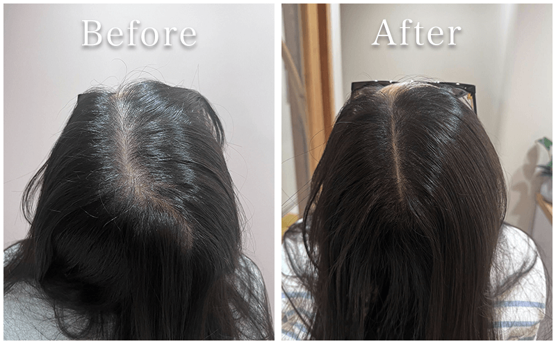 アートメイク症例3