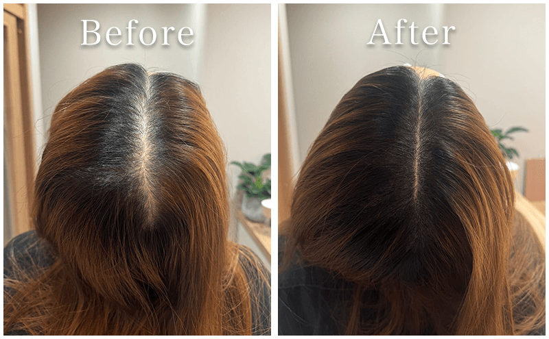 アートメイク症例4